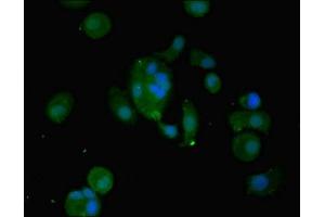 Immunofluorescent analysis of MCF-7 cells using ABIN7175671 at dilution of 1:100 and Alexa Fluor 488-congugated AffiniPure Goat Anti-Rabbit IgG(H+L)