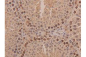Used in DAB staining on fromalin fixed paraffin-embedded Kidney tissue (SOD1 anticorps  (AA 2-154))