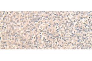 anti-DEAD (Asp-Glu-Ala-Asp) Box Polypeptide 59 (DDX59) antibody