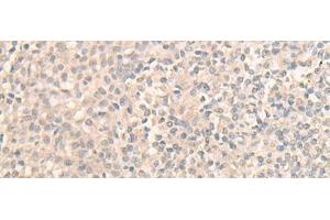 Immunohistochemistry of paraffin-embedded Human tonsil tissue using DDX59 Polyclonal Antibody at dilution of 1:30(x200) (DDX59 anticorps)