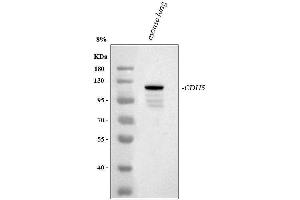 Western blot analysis of VE Cadherin using anti-VE Cadherin antibody (ABIN5692987).