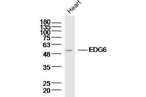 Mouse heart lysates probed with EDG6 Polyclonal Antibody, unconjugated  at 1:300 overnight at 4°C followed by a conjugated secondary antibody at 1:10000 for 90 minutes at 37°C. (S1PR4 anticorps  (AA 301-384))