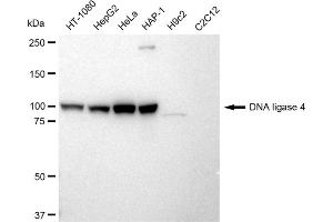 Western blotting analysis using DNA ligase 4 antibody (ABIN7799266).