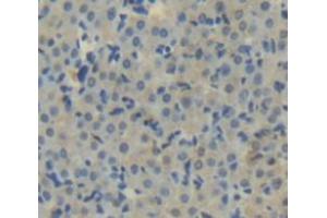 IHC-P analysis of Human Tissue, with DAB staining. (Aconitase 1 anticorps  (AA 251-443))