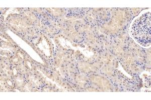 Detection of Tie1 in Human Kidney Tissue using Monoclonal Antibody to Tyrosine Kinase With Immunoglobulin Like And EGF Like Domains Protein 1 (Tie1)