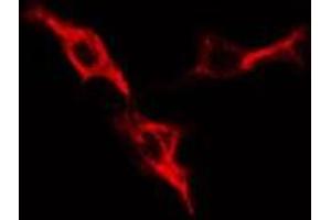 ABIN6276412 staining HepG2 cells by IF/ICC.