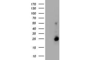 Image no. 2 for anti-Ubiquitin-Conjugating Enzyme E2E 3 (UBE2E3) antibody (ABIN1501622) (UBE2E3 anticorps)