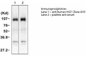 Image no. 1 for anti-Hepatocyte Growth Factor (Hepapoietin A, Scatter Factor) (HGF) antibody (ABIN331456) (HGF anticorps)