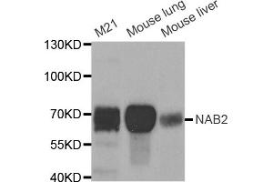Western blot analysis of extracts of various cell lines, using NAB2 antibody (ABIN5973441) at 1/1000 dilution. (NAB2 anticorps)