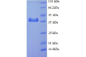 SDS-PAGE (SDS) image for Sperm Mitochondria Associated Cysteine Rich Protein (SMCP) (AA 1-116), (full length) protein (GST tag) (ABIN5710380)