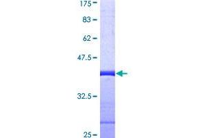 Image no. 1 for Transcription Elongation Factor SPT5 (SUPT5H) (AA 981-1087) protein (GST tag) (ABIN1321917)