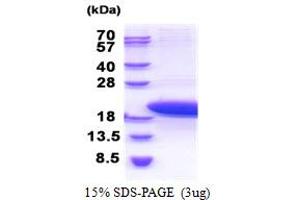 Parathymosin (PTMS) (AA 1-102) protein (His tag)