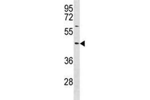 TXNIP antibody western blot analysis in NCI-H292 lysate.