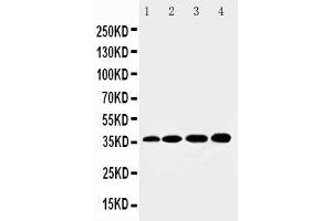 Anti-HSD17B1 antibody, Western blotting Lane 1: Rat Kidney Tissue Lysate Lane 2: Rat Liver Tissue Lysate Lane 3: 293T Cell Lysate Lane 4: HELA Cell Lysate (HSD17B1 anticorps  (N-Term))