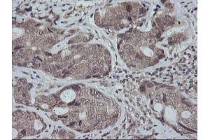 Image no. 9 for anti-Mitogen-Activated Protein Kinase Kinase 3 (MAP2K3) antibody (ABIN1499403)