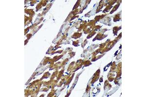 Immunohistochemistry of paraffin-embedded Rat heart using TMX2 Rabbit pAb (ABIN7270810) at dilution of 1:100 (40x lens).