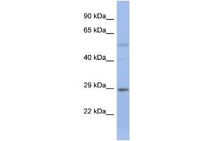 Host:  Rabbit  Target Name:  STEAP1B  Sample Type:  Fetal Small Intestine lysates  Antibody Dilution:  1. (STEAP1B anticorps  (N-Term))