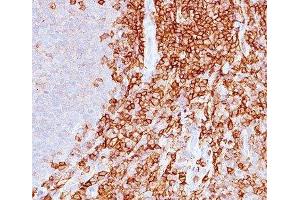 IHC staining of spleen with CD43 antibody (DF-T1). (CD43 anticorps)