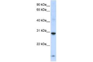 Western Blot showing ZNF138 antibody used at a concentration of 1-2 ug/ml to detect its target protein. (ZNF138 anticorps  (Middle Region))