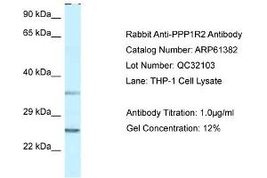 Western Blotting (WB) image for anti-Protein Phosphatase 1, Regulatory (Inhibitor) Subunit 2 (PPP1R2) (N-Term) antibody (ABIN2788785) (PPP1R2 anticorps  (N-Term))