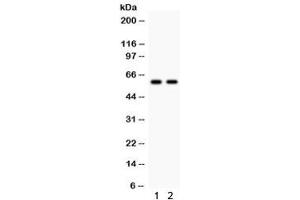 Western blot testing of 1) rat kidney and 2) human MCF7 lysate with CYP1B1 antibody. (CYP1B1 anticorps  (AA 255-480))