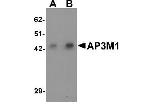 Western blot analysis of AP3M1 in human brain tissue lysate with AP3M1 antibody at (A) 1 and (B) 2 µg/mL . (AP3M1 anticorps  (C-Term))