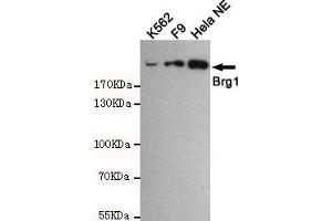 Western blot detection of BRG1 in Hela NE,F9 and K562 cell lysates using BRG1 mouse mAb (1:1000 diluted). (SMARCA4 anticorps)