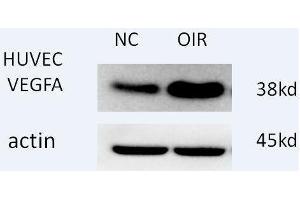 Western blot analysis of extracts of H460 cells, using antibody at 1:1000 dilution. (VEGFA anticorps  (AA 1-147))