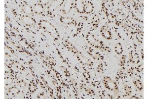 ABIN6272436 at 1/100 staining Human kidney tissue by IHC-P. (ELP2 anticorps  (Internal Region))