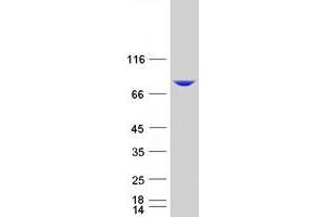Validation with Western Blot