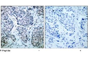 Image no. 1 for anti-Mitogen-Activated Protein Kinase Kinase 4 (MAP2K4) (pThr261) antibody (ABIN196908) (MAP2K4 anticorps  (pThr261))
