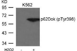 Image no. 2 for anti-Docking Protein 1, 62kDa (Downstream of tyrosine Kinase 1) (DOK1) (pTyr398) antibody (ABIN197042) (DOK1 anticorps  (pTyr398))