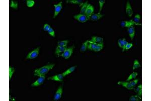 Immunofluorescent analysis of Hela cells using ABIN7143250 at dilution of 1:100 and Alexa Fluor 488-congugated AffiniPure Goat Anti-Rabbit IgG(H+L) (APEH anticorps  (AA 201-500))