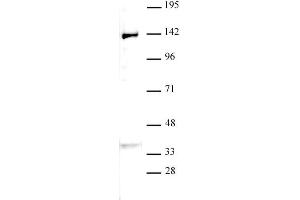 JMJD2B / KDM4B antibody (pAb) tested by Western blot. (KDM4B anticorps  (C-Term))