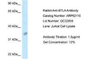 Western Blotting (WB) image for anti-B and T Lymphocyte Associated (BTLA) (Middle Region) antibody (ABIN2789022) (BTLA anticorps  (Middle Region))