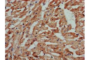 IHC image of ABIN7170573 diluted at 1:800 and staining in paraffin-embedded human heart tissue performed on a Leica BondTM system.