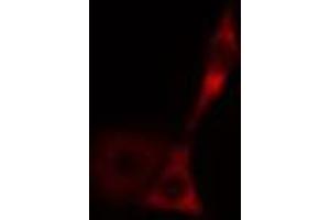 ABIN6269010 staining HeLa cells by IF/ICC. (HSPA9 anticorps  (C-Term))