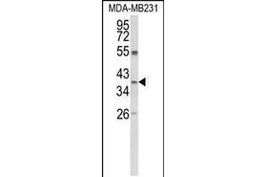 Western blot analysis of ARG1 Antibody in MDA-MB231 cell line lysates (35ug/lane) (Liver Arginase anticorps  (C-Term))