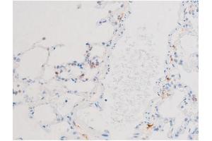 ABIN6267576 at 1/200 staining Rat lung tissue sections by IHC-P. (Smad2/3 anticorps  (pThr8, Thr8))
