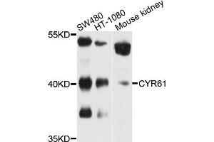 Western blot analysis of extracts of various cell lines, using CYR61 antibody (ABIN5970462) at 1/1000 dilution. (CYR61 anticorps)