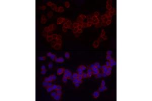 Immunofluorescence analysis of THP-1 cells using CD18 Rabbit pAb (ABIN3023117, ABIN3023118, ABIN3023119 and ABIN6219398) at dilution of 1:50 (40x lens).
