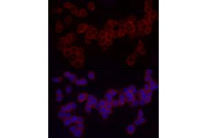 Immunofluorescence analysis of THP-1 cells using CD18 Rabbit pAb (ABIN3023117, ABIN3023118, ABIN3023119 and ABIN6219398) at dilution of 1:50 (40x lens). (Integrin beta 2 anticorps  (AA 70-170))