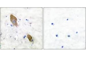 Immunohistochemistry analysis of paraffin-embedded human brain, using PYK2 (Phospho-Tyr881) Antibody. (PTK2B anticorps  (pTyr881))