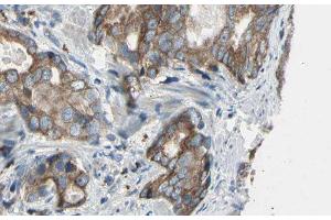 ABIN6276478 at 1/100 staining Human prostate tissue by IHC-P. (ACTR3 anticorps  (C-Term))
