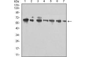 Western blot analysis using CD96 mouse mAb against Hela (1), Jurkat (2), MOLT4 (3), Raji (4), HL-60 (5), U937 (6), and C6 (7) cell lysate.