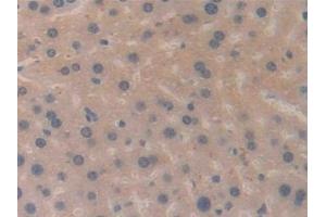 Detection of MGEA5 in Mouse Liver Tissue using Polyclonal Antibody to Meningioma Expressed Antigen 5 (MGEA5)