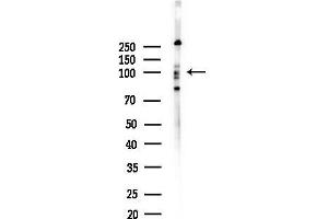 anti-Leucyl-tRNA Synthetase 2, Mitochondrial (LARS2) (Internal Region) antibody