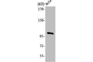 Western Blot analysis of HeLa cells using PMS2 Polyclonal Antibody (PMS2 anticorps  (Internal Region))