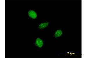 Immunofluorescence of monoclonal antibody to GTF2A1L on HeLa cell.