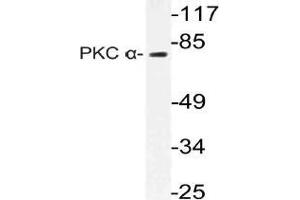 Western blot (WB) analysis of PKC alpha antibody in extracts from Jurkat cells. (PKC alpha anticorps)